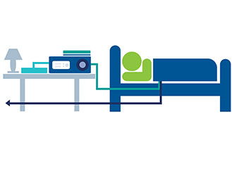 Peritoneal Dialysis